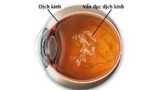 VẨN ĐỤC DỊCH KÍNH